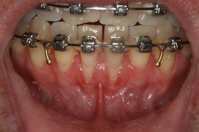 ortho c1 1
