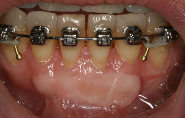 ortho c1 2