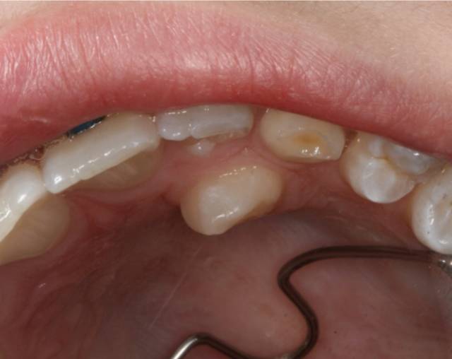 ortho c2 1